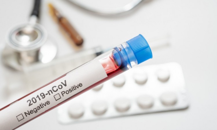 Praėjusią parą patvirtinti 139 koronaviruso atvejai
