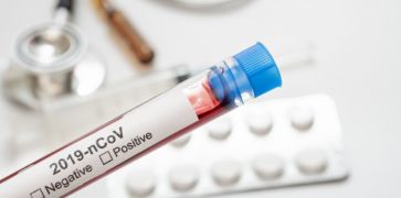 Lietuvoje patvirtinta šiuo metu 83 koronaviruso infekcijos atvejų